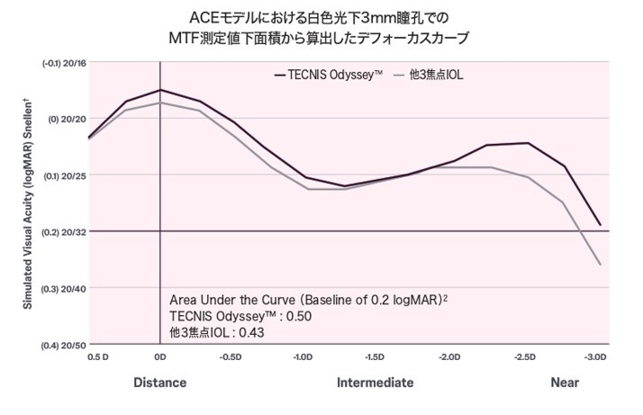 連続焦点レンズ：シナジーよりは手元は見えずらい