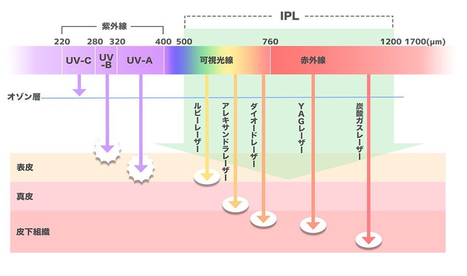 IPL(フォトフェイシャル)について