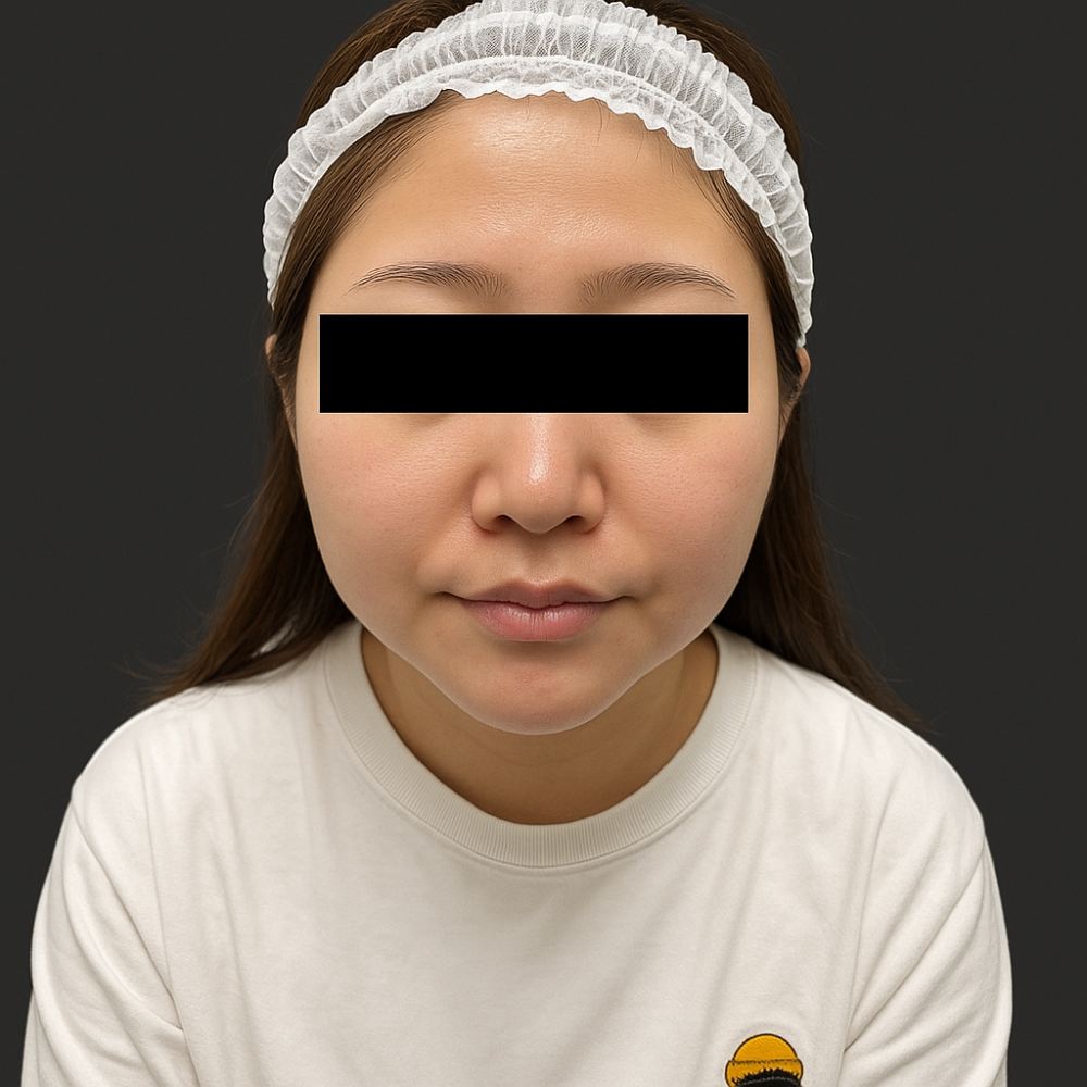 B様　(AFTER)