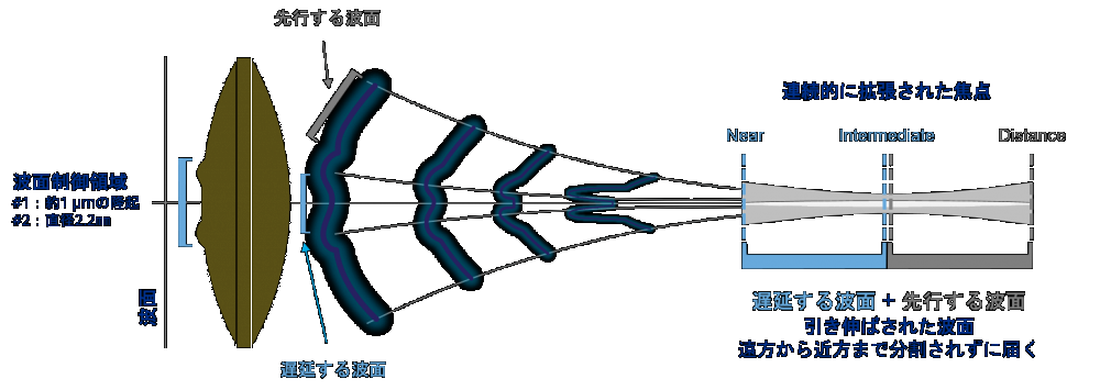 焦点深度拡張型（EDOF）眼内レンズ