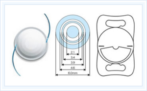 屈折型多焦点眼内レンズ