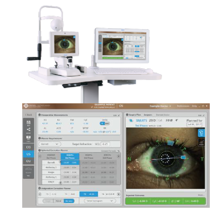 VERIONによる高精度な軸合わせ