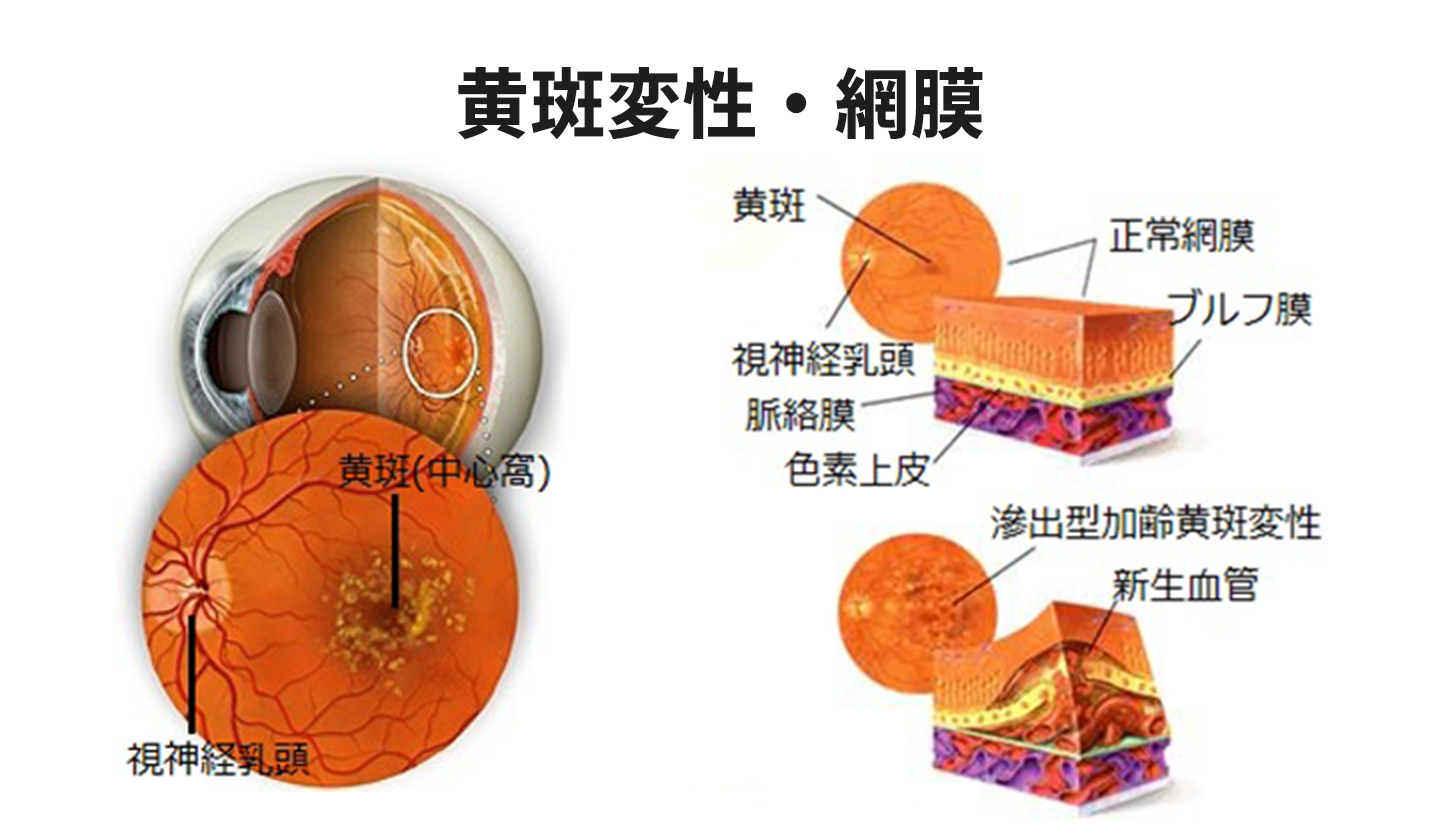 黄斑変性・網膜 診療