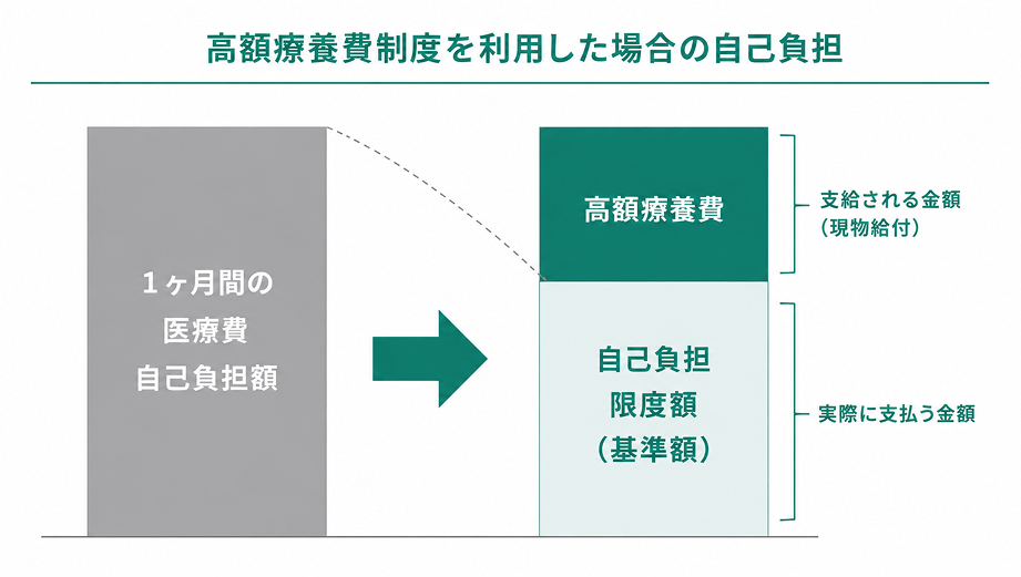 高額療養費制度を利用した場合の自己負担：1ヶ月間の医療費自己負担額から、自己負担限度額（基準額）を実際に支払う金額とし、超えた分が高額療養費として支給されることを示す図