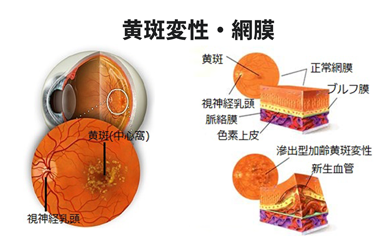 黄斑変性と網膜の構造