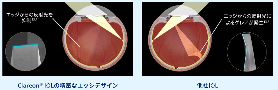 クラレオン パンオプティクス(Clareon®PanOptix®)の安定性