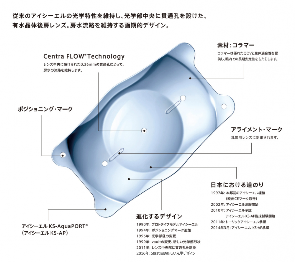 トーリックICL(乱視矯正眼内コンタクト)とは?